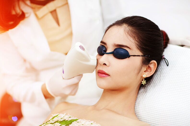 Rajeunissement au laser