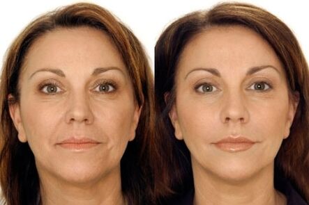 Massage du visage avant et après